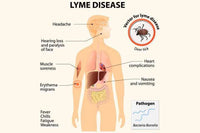 Thumbnail for Lyme Lab Test - DNA Connexions DNA Connexions Lab Test Kit - Conners Clinic