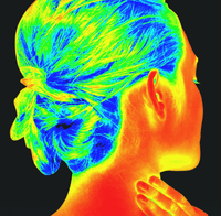 Thumbnail for Thermography - annual re-scan Conners Clinic Service - Conners Clinic