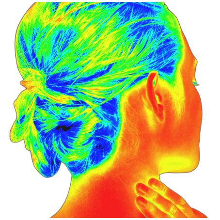 Thermography - upper body (with or without breast) Conners Clinic Service - Conners Clinic